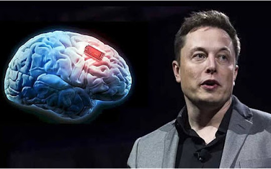Musk: Patients implanted with Neuralink brain chips “recovered well”